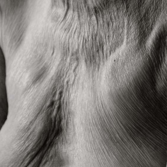 Métamorphoses – Botox City