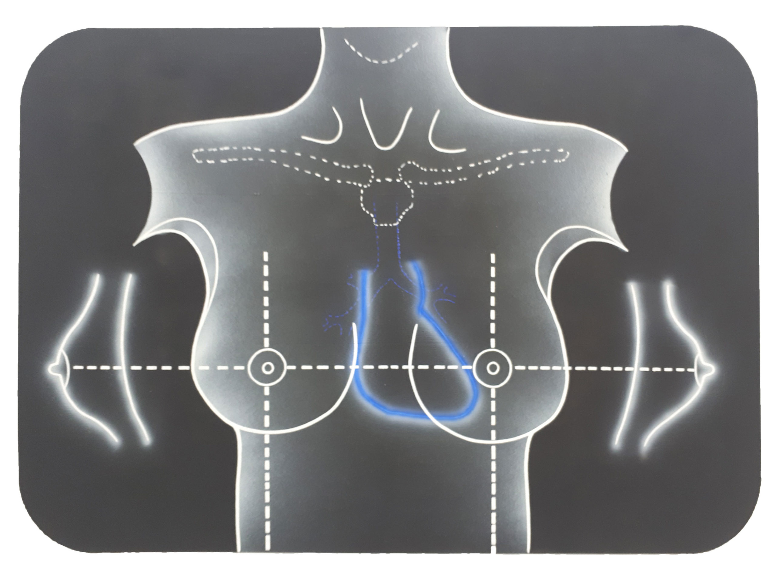 Kiki Kogelnik, œuvre de 1967